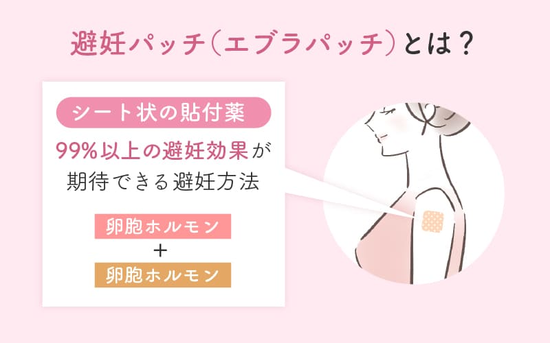 避妊パッチ（エブラパッチ）とは