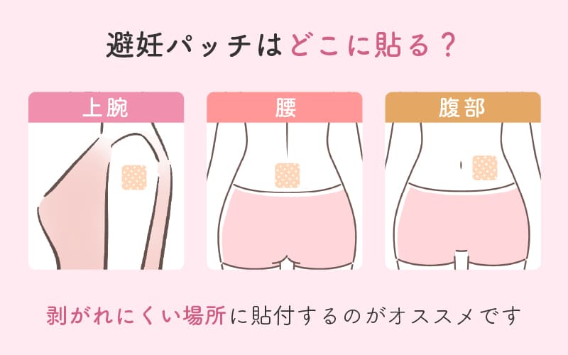 避妊パッチを貼る場所